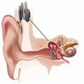 исследование слуха