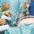 Визуализация Оперативная лапароскопия при кистах и кистомах яичника