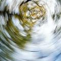 периферическая вестибулопатия, вестибулярный нейронит периферическая вестибулопатия, вестибулярный нейронит